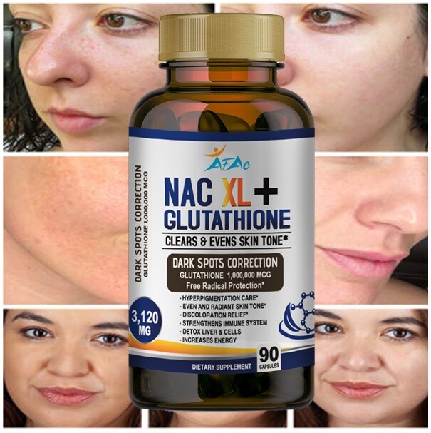 L Glutathione NAC Collagen Skin White Dark Spots Acne Scar Remova