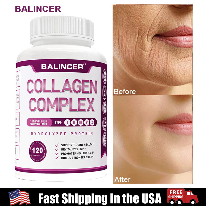 Collagen complex types I, II, III, V and X, supporting for bones, hair and nails