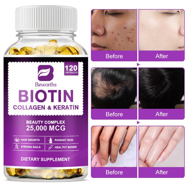 Biotin Collagen& Keratin 5000mcg-Promotes Hair Growth,Supports Joint Health