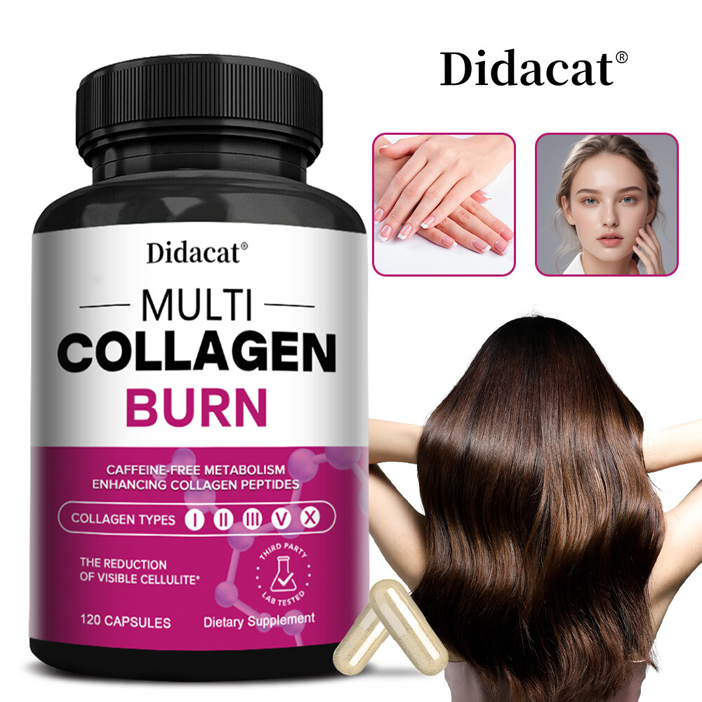 Multi Collagen Burn Capsules for Weight Loss – Hydrolyzed Collagen Peptides