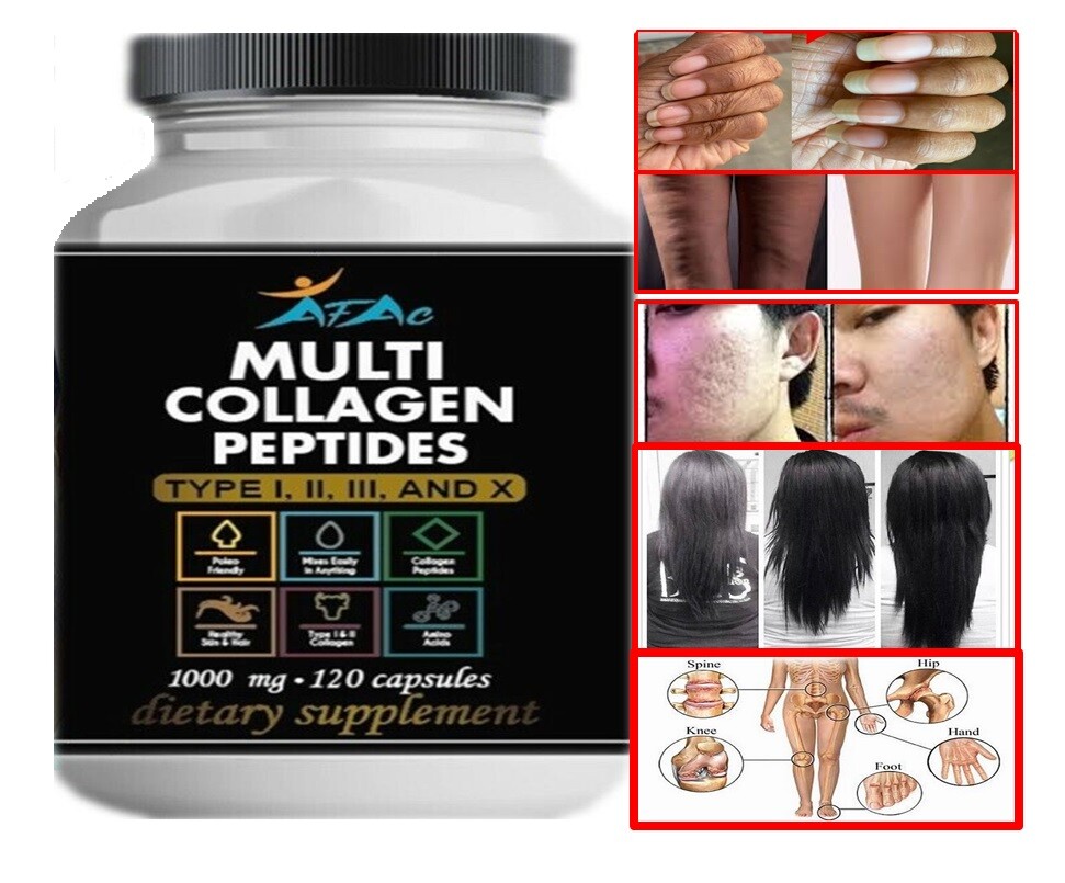 Nutrition Multi Collagen Pills mg 1000mg 120 Capsule | Hair, Skin, Nails, Joint
