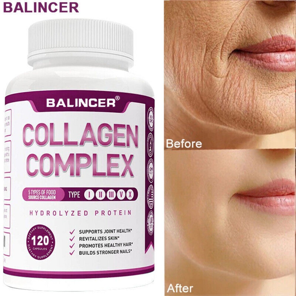 Collagen Complex Types I II III V X Supports Bone Hair Nails Health 120 Capsules