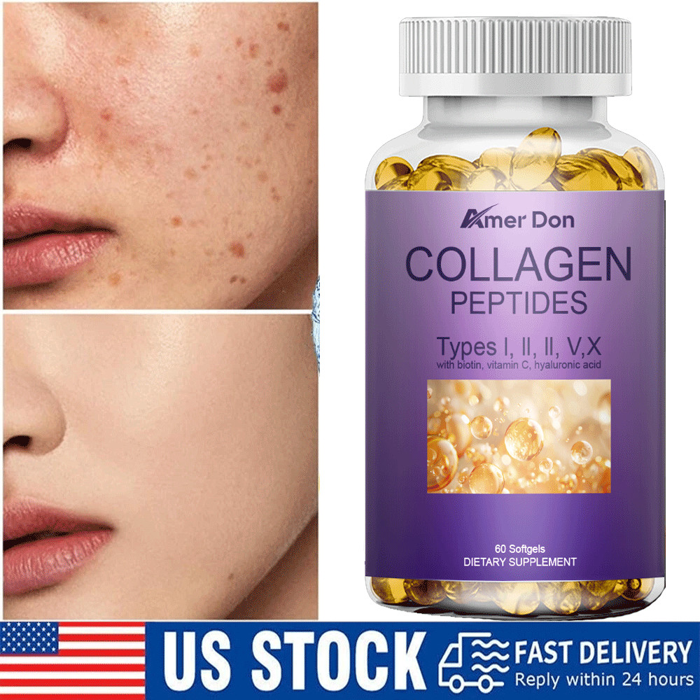 Collagen Peptides Pills 10888mg Hydrolyzed Anti Aging Capsule Types I,II,III,V,X